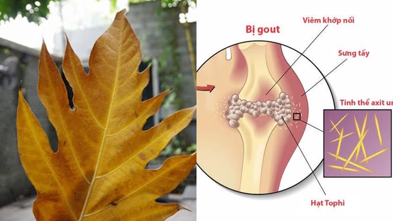 Giúp giảm lượng axit uric gây bệnh gout